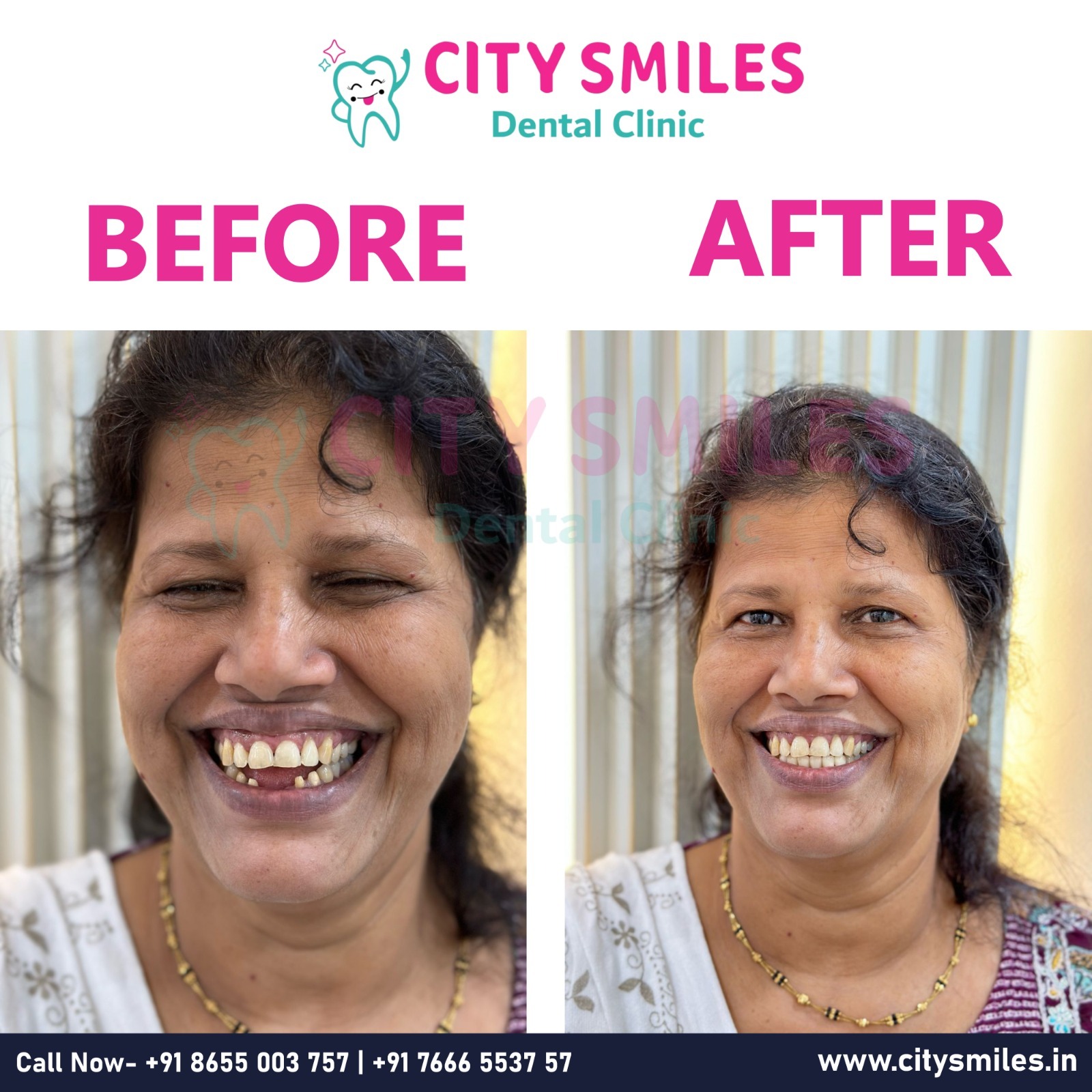  Transforming Smiles, Transforming Lives! 