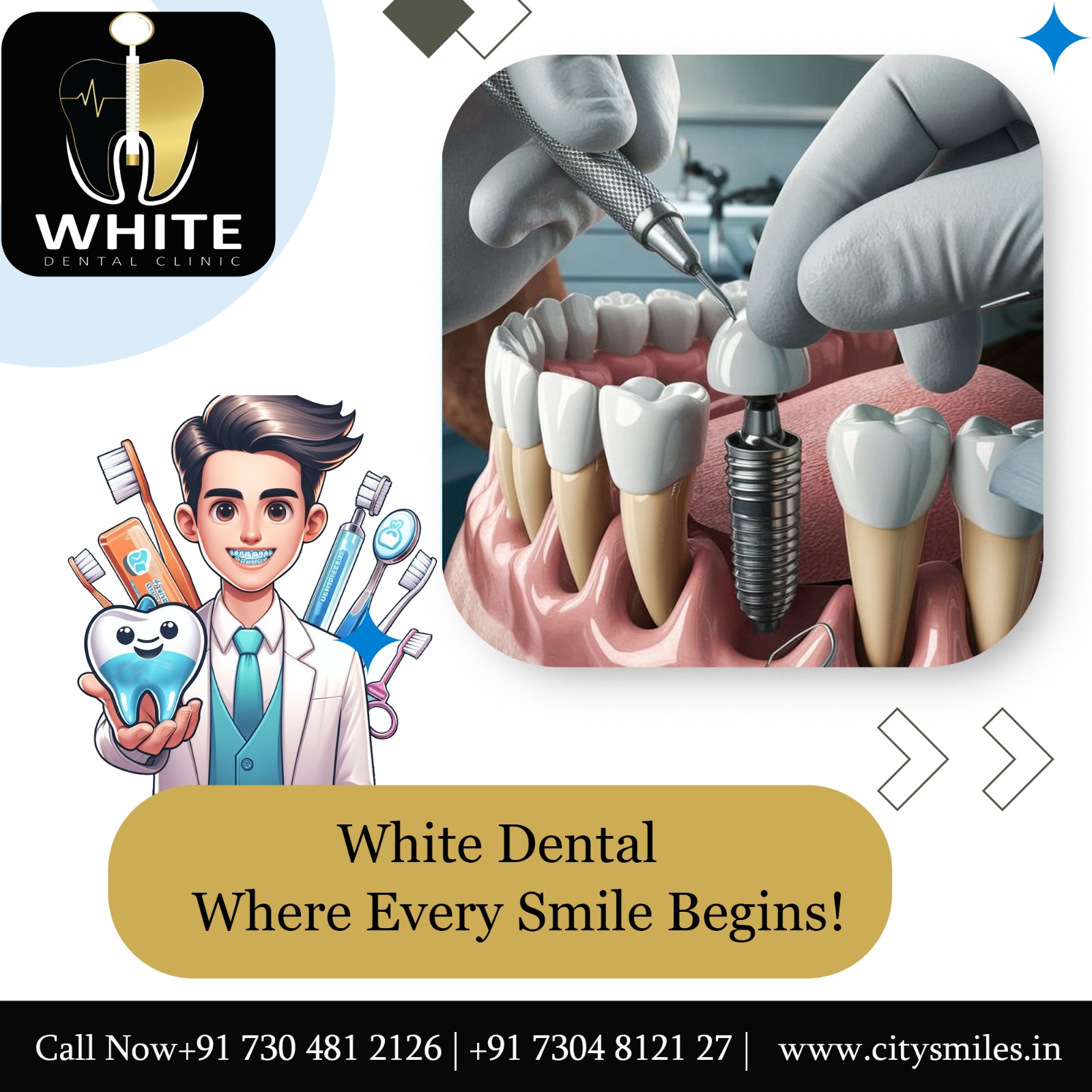  Restore Your Smile with Confidence at White Dental Clinic! 