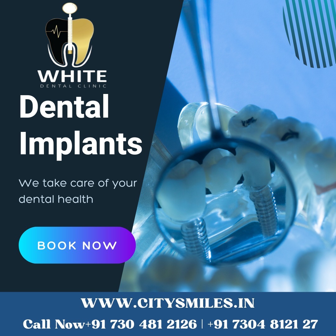 Restore Your Smile with White Dental Clinic!