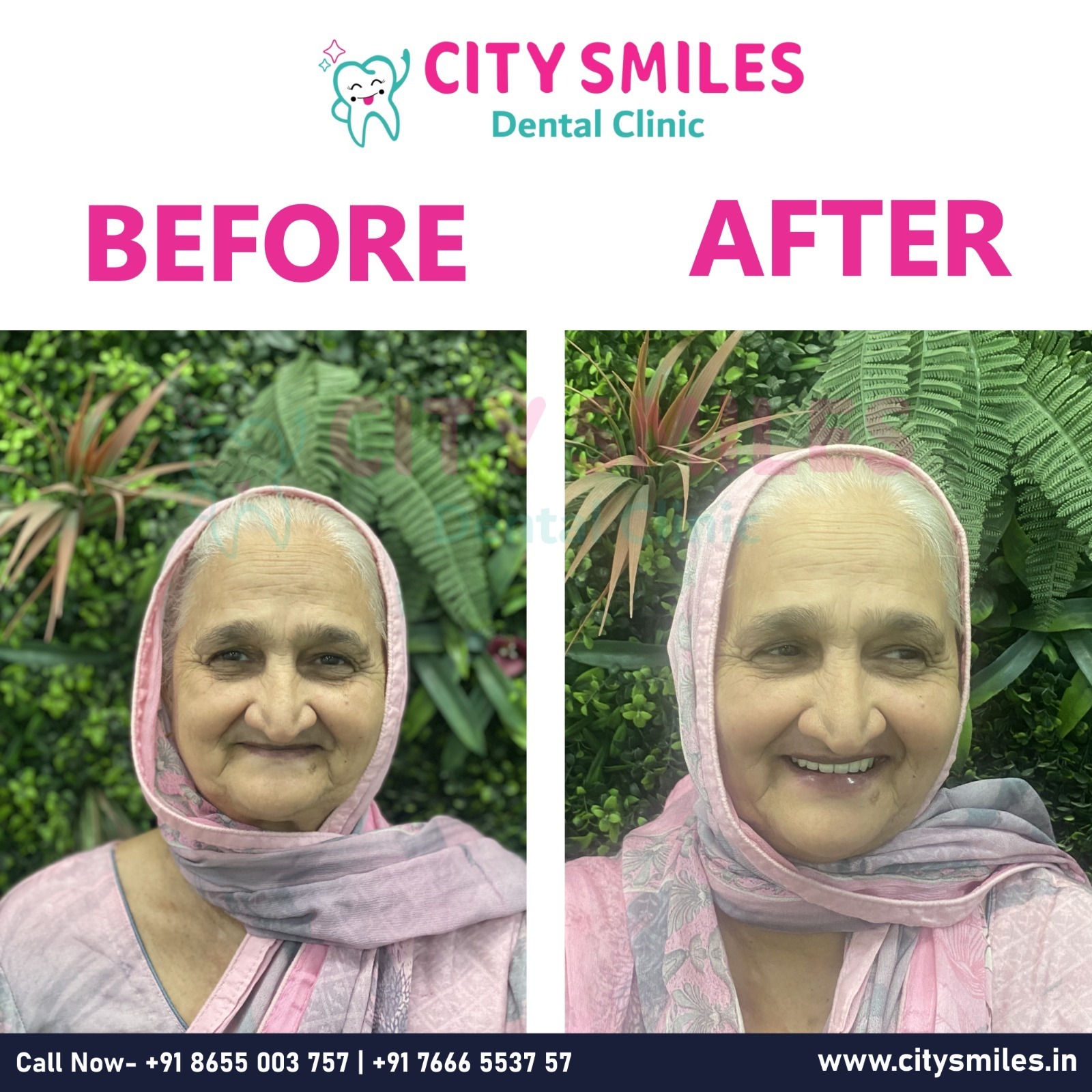 Transform Your Smile – Because You Deserve to Shine!