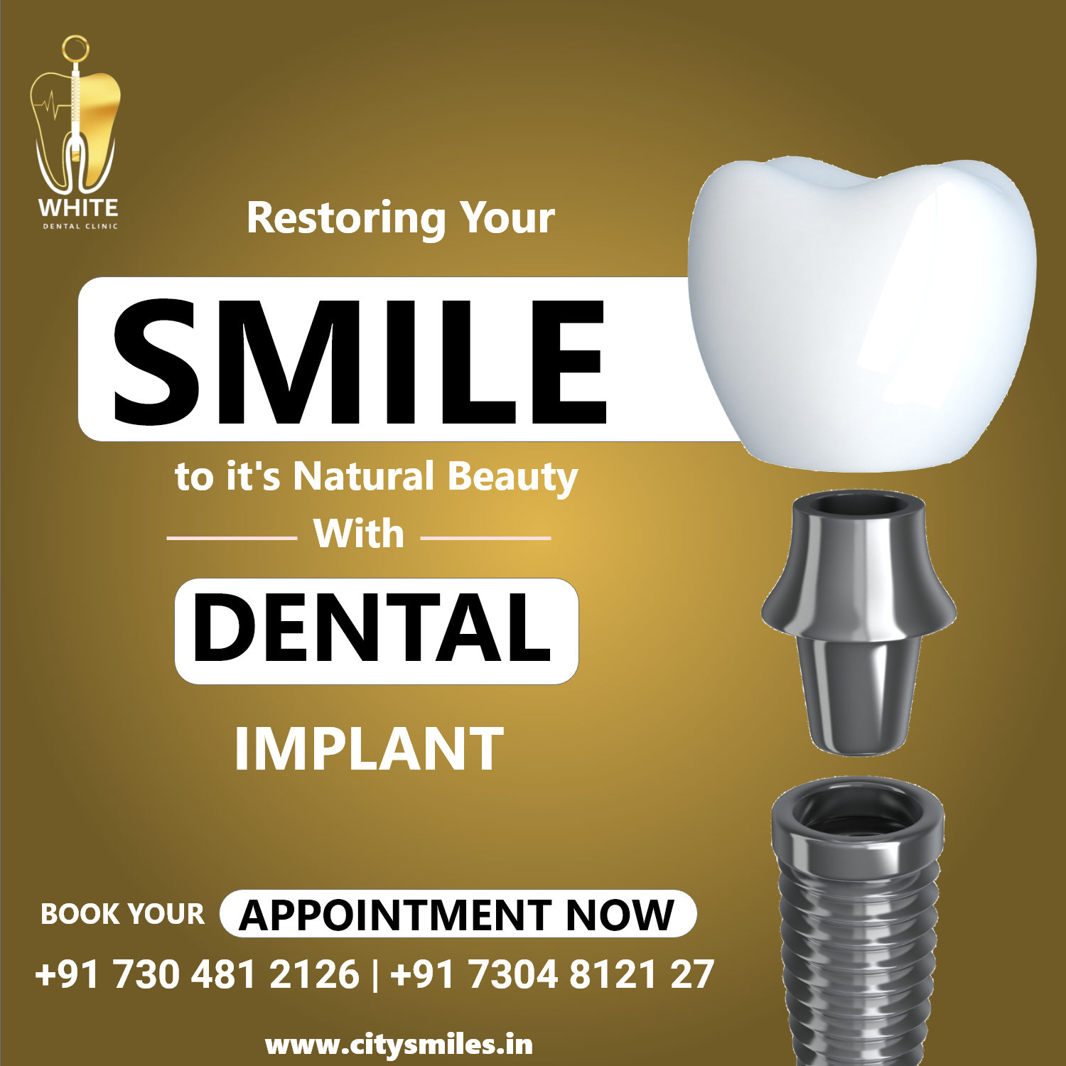 Restoring Your SMILE to Its Natural Beauty with DENTAL IMPLANTS