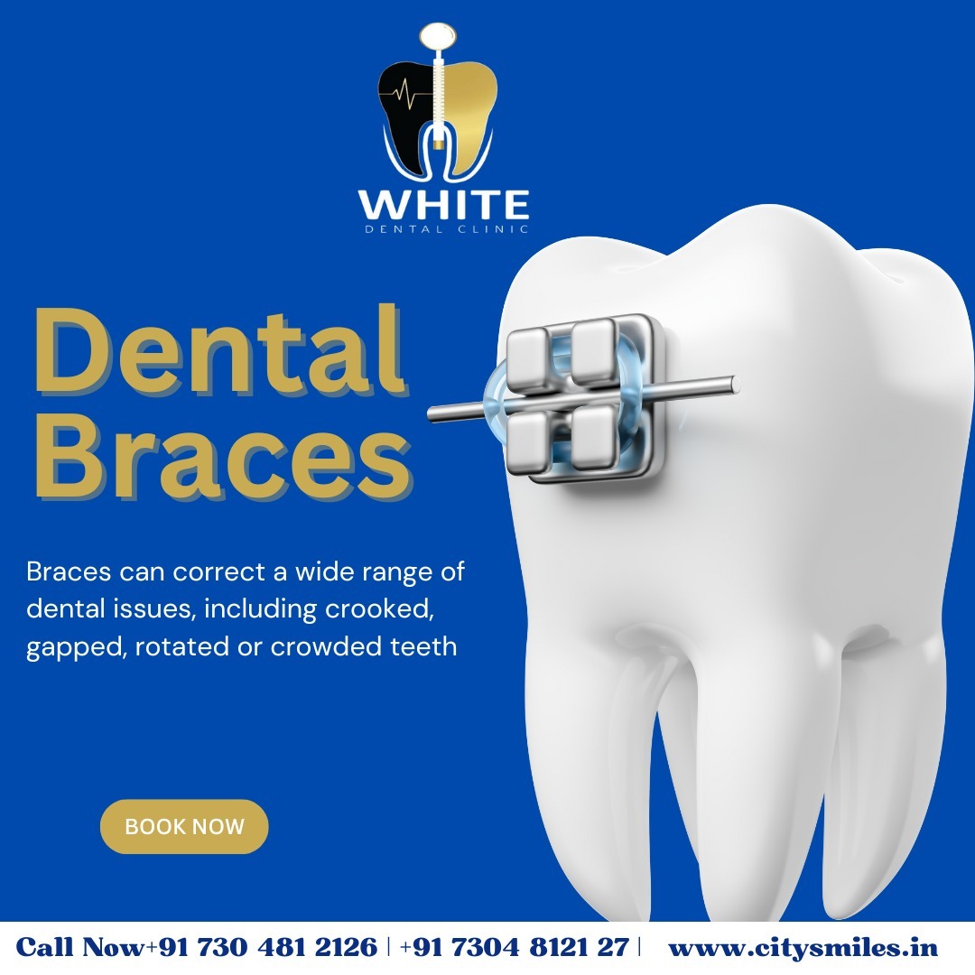  A Confident Smile Begins with Straight Teeth! 