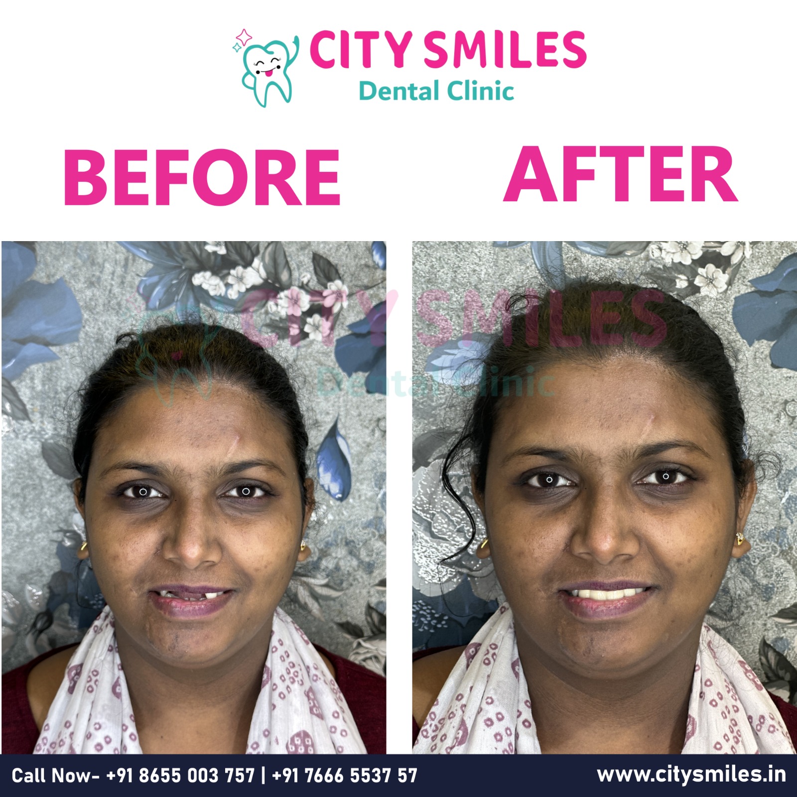  City Smiles Dental Clinic - Your Smile, Our Priority! 
