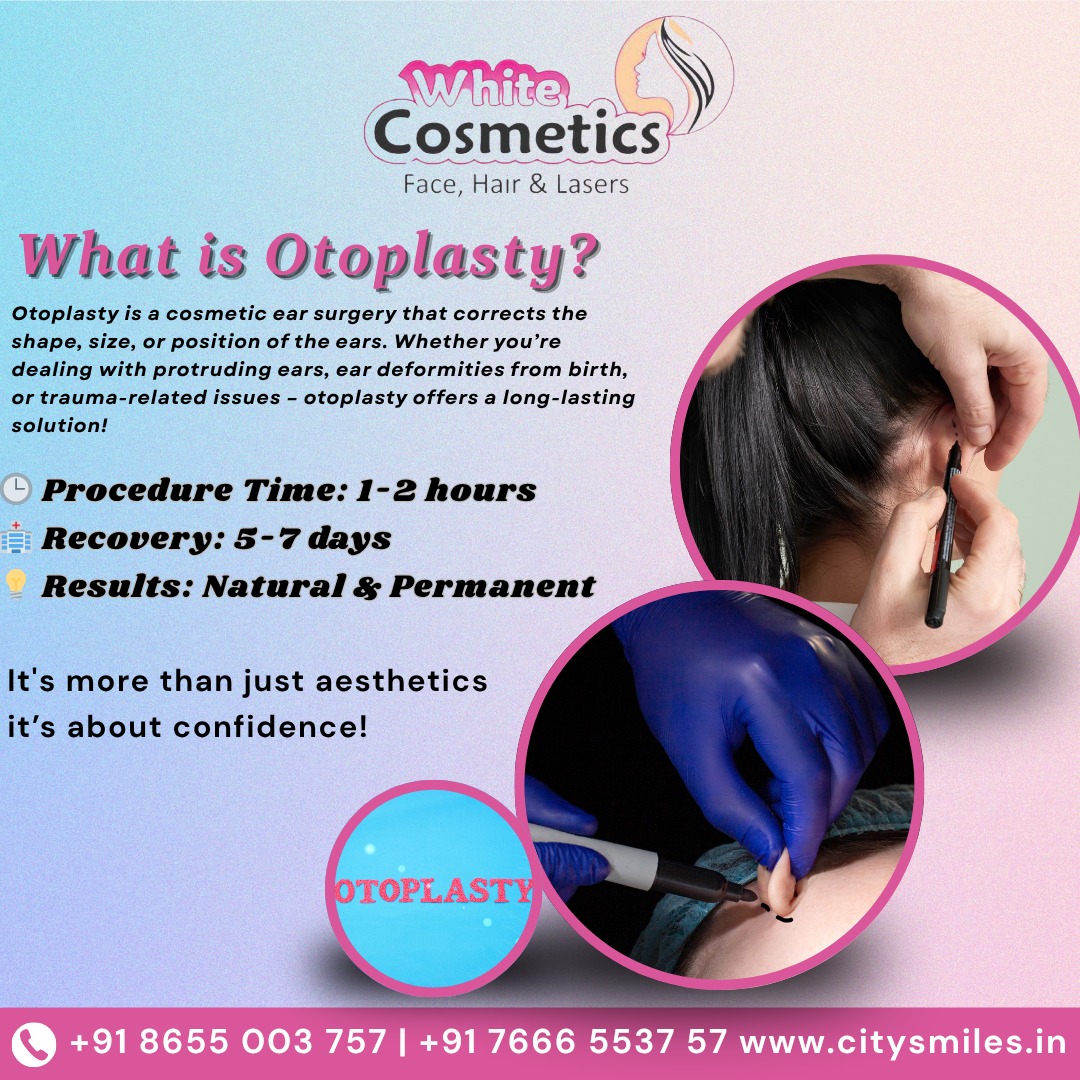 Rediscover your confidence with Otoplasty at White Cosmetics!5