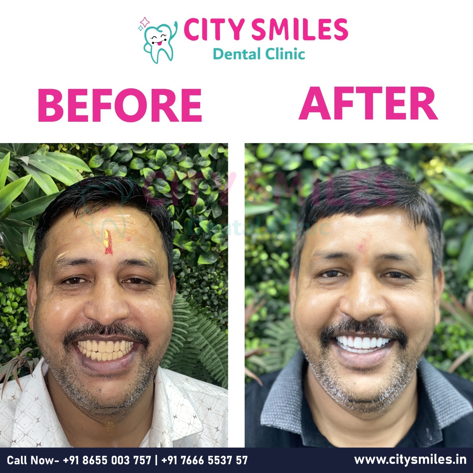  TRANSFORMATION THAT SPEAKS FOR ITSELF! 
