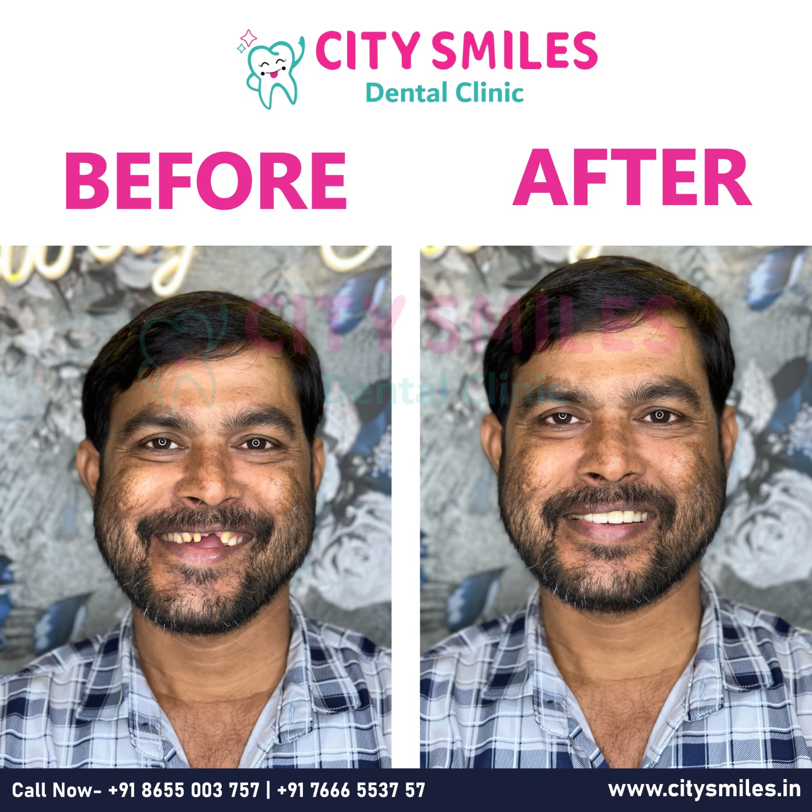  Witness the Magic of a Confident Smile! 
