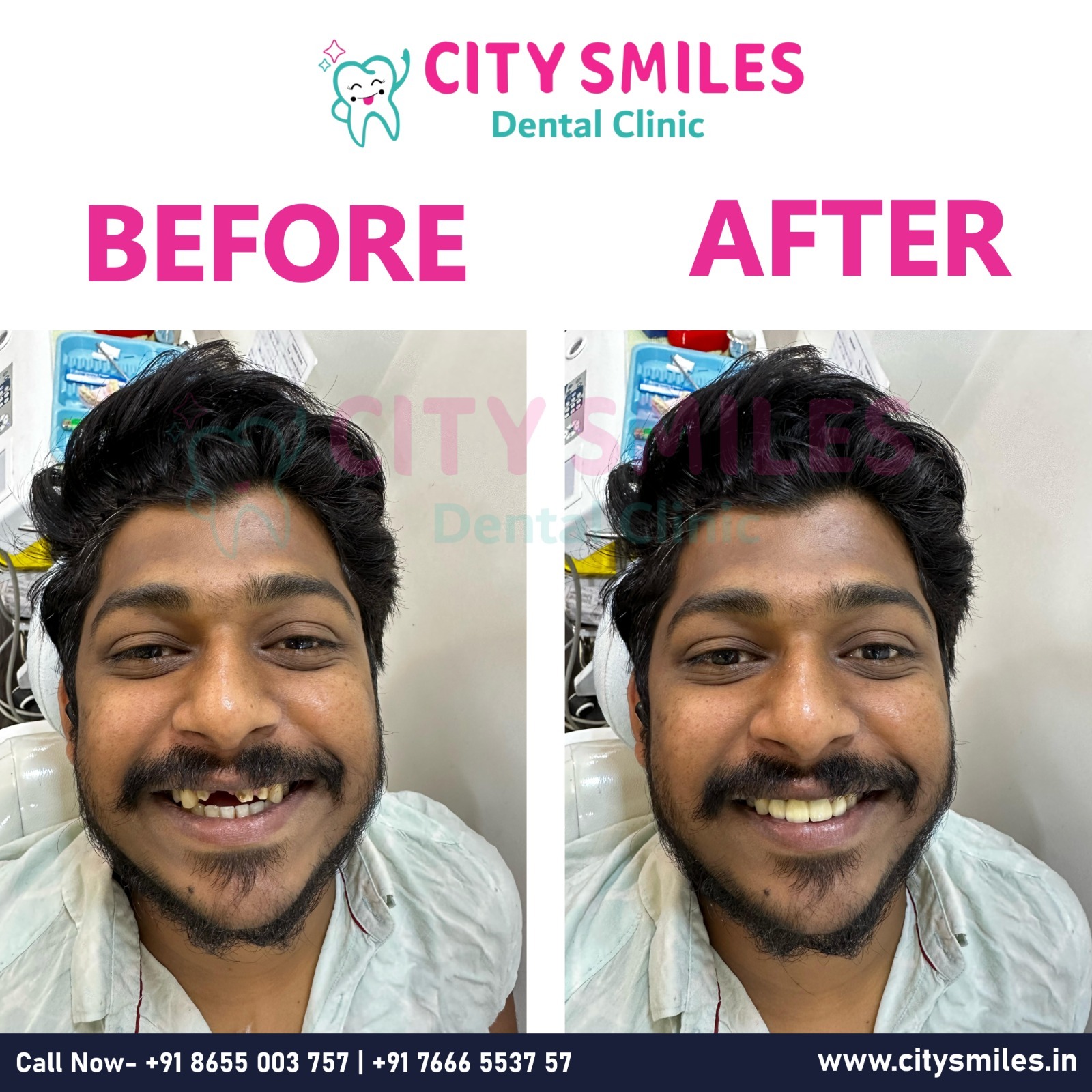 Transform Your Smile with CITY SMILES Dental Clinic