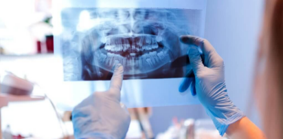 Dental Xray (Digital)