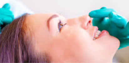 Rhinoplasty