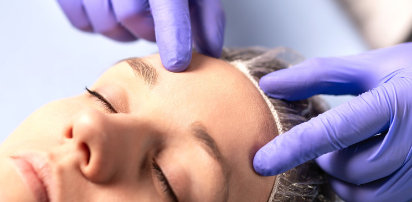 Forehead Reduction