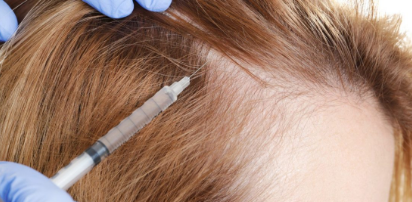 Hair PRP / GFC therapy for regrowth and volume
