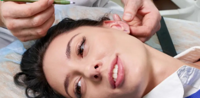 Auroplasty