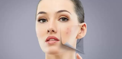 Acne & Scar Management