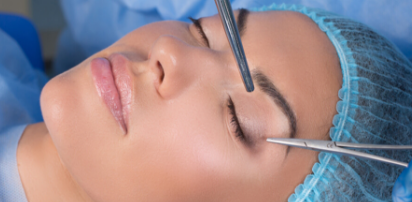 Blepharoplasty