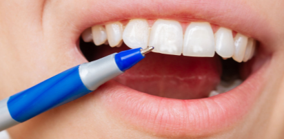 Fluorosis