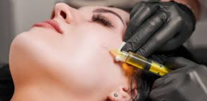 Face PRP & GFC treatment