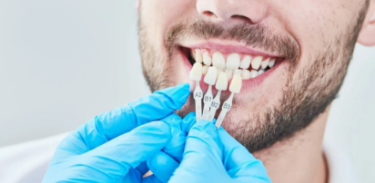 Veneers