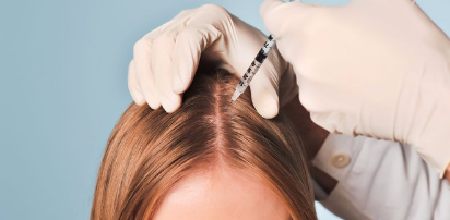 Steroid Treatment for Alopecia