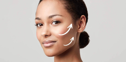 Face Lift by PDO Threads, COG threads
